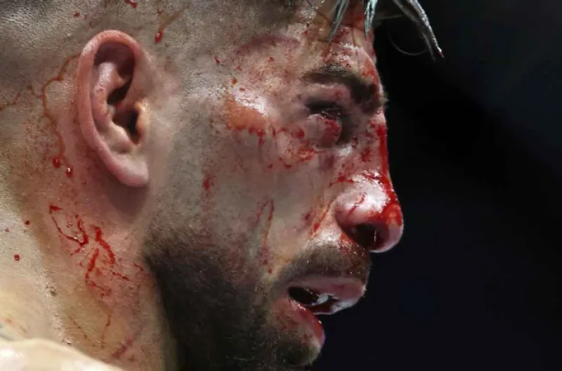 Gaethje Cetak Sejarah di Gedung Putih, Rebut Sabuk Kelas Ringan UFC; Gane Kuasai Gelar Interim Kelas Berat